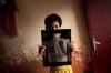 Gilang holding an x-ray photo of his damaged right lung as a result of the Bronchiectasis